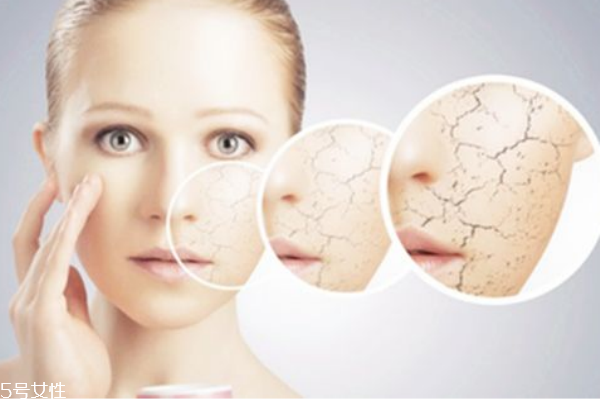 臉部干燥起皮怎么辦 秋冬干皮大拯救 臉部干燥起皮怎么辦 秋冬干皮大拯救