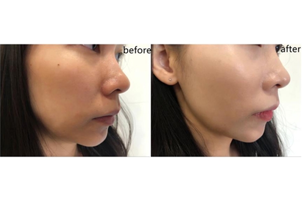 卡姿蘭蝸牛氣墊適合什么年齡 學(xué)生族最愛