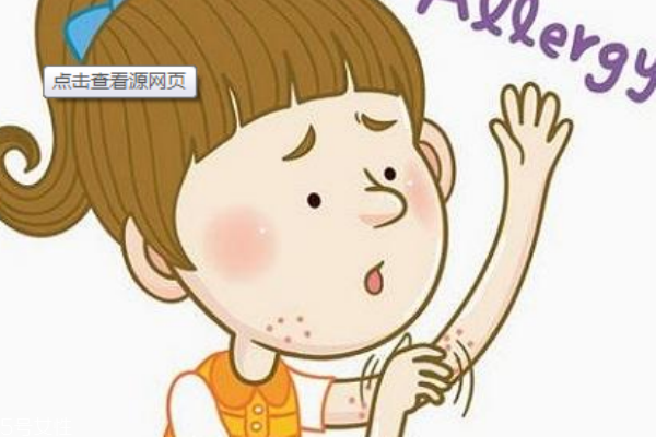 神經(jīng)性皮炎是什么 怎么護理 神經(jīng)性皮炎是什么 怎么護理