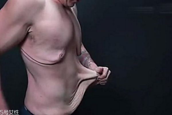 皮膚松弛，你應(yīng)該為肌膚補(bǔ)充營(yíng)養(yǎng)