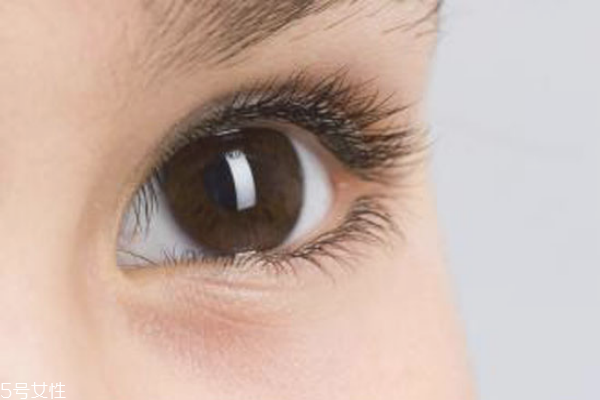 麥粒腫熱敷有用嗎 麥粒腫熱敷還是冷敷 麥粒腫熱敷有用嗎 麥粒腫熱敷還是冷敷