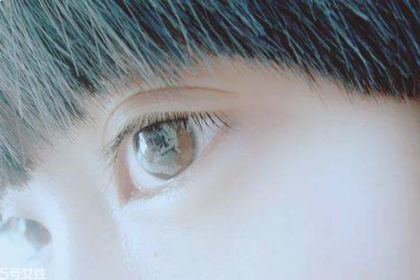 麥粒腫可以自己挑破嗎 麥粒腫手術多久恢復 麥粒腫可以自己挑破嗎 麥粒腫手術多久恢復