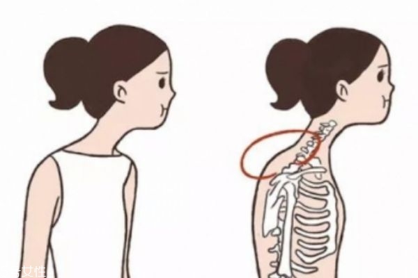 富貴包的危害 你一定要注意 富貴包的危害 你一定要注意