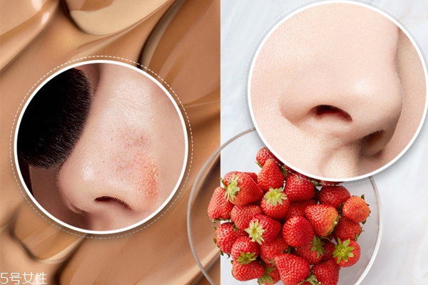 極美肌去黑頭管用嗎 趕走黑頭不是夢 極美肌去黑頭管用嗎 趕走黑頭不是夢