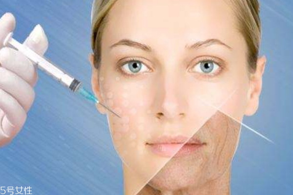 除皺的方法很多，你適合哪一種