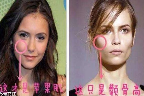 蘋(píng)果肌和顴骨高區(qū)別 別再傻傻分不清楚