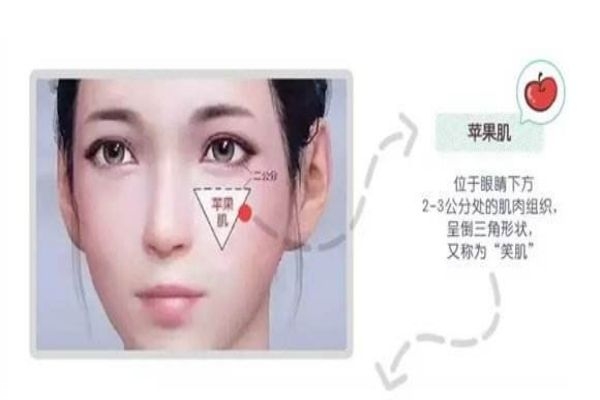 蘋(píng)果肌和顴骨高區(qū)別 別再傻傻分不清楚