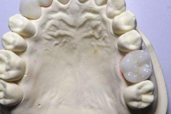 ?裝假牙后牙齦腫脹流血怎么辦 ?裝假牙后牙齦腫脹流血怎么辦