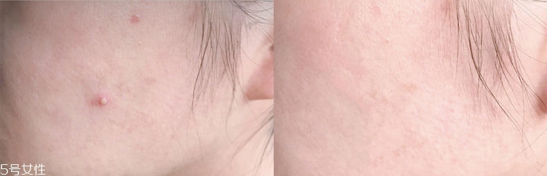 2019醫(yī)美面膜哪個(gè)牌子好 5大熱門醫(yī)美面膜pk 2019醫(yī)美面膜哪個(gè)牌子好 5大熱門醫(yī)美面膜pk