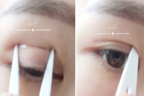 腫眼泡適合什么雙眼皮貼 選擇雙眼皮貼小技巧 腫眼泡適合什么雙眼皮貼 選擇雙眼皮貼小技巧