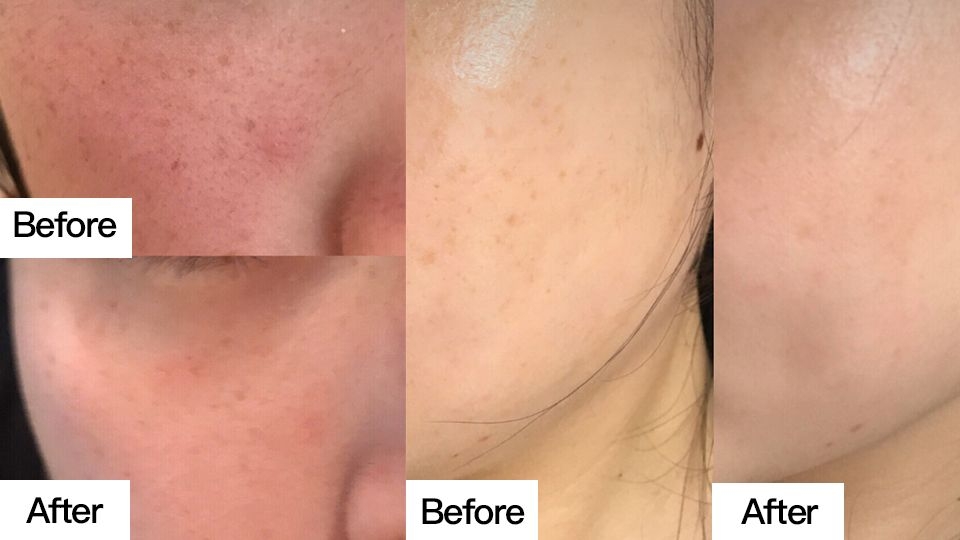 祛斑膏哪個(gè)牌子好 爆款祛斑膏推薦 祛斑膏哪個(gè)牌子好 爆款祛斑膏推薦