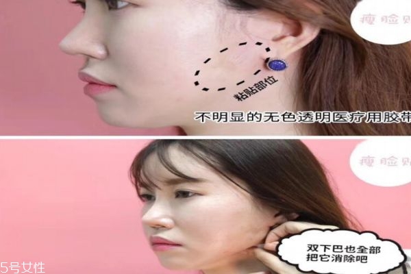 瘦臉貼有用嗎 抖音同款瘦臉貼 瘦臉貼有用嗎 抖音同款瘦臉貼