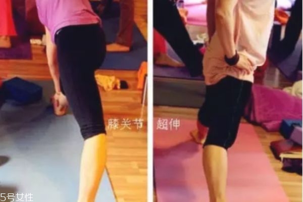 膝蓋超伸怎么矯正 如何正確處理膝超伸 膝蓋超伸怎么矯正 如何正確處理膝超伸