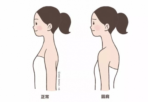 圓肩駝背怎么矯正 教你如何矯正圓肩駝背 圓肩駝背怎么矯正 教你如何矯正圓肩駝背
