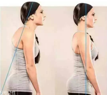 圓肩駝背怎么矯正 教你如何矯正圓肩駝背 圓肩駝背怎么矯正 教你如何矯正圓肩駝背