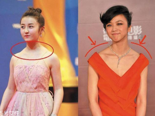 圓肩駝背怎么矯正 教你如何矯正圓肩駝背 圓肩駝背怎么矯正 教你如何矯正圓肩駝背