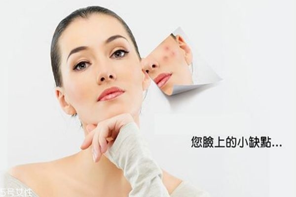 痘痘肌用什么水乳好 造成痘痘肌的原因 痘痘肌用什么水乳好 造成痘痘肌的原因