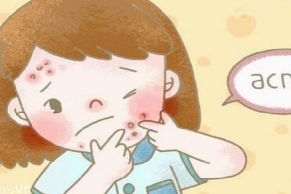 博樂達(dá)水楊酸面膜用法 適用于什么皮膚 博樂達(dá)水楊酸面膜用法 適用于什么皮膚