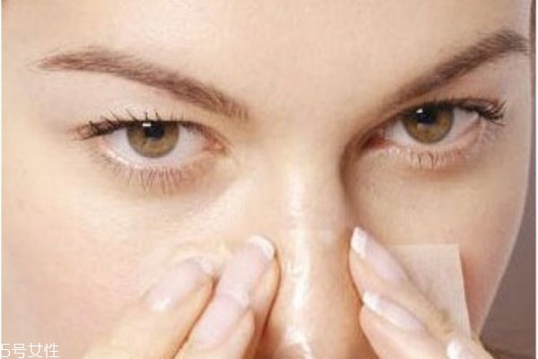 鼻子上黑頭多怎么辦 鼻子黑頭多的原因 鼻子上黑頭多怎么辦 鼻子黑頭多的原因