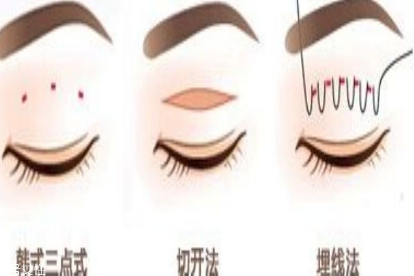 韓式三點和埋線的區(qū)別 你適合做什么樣的