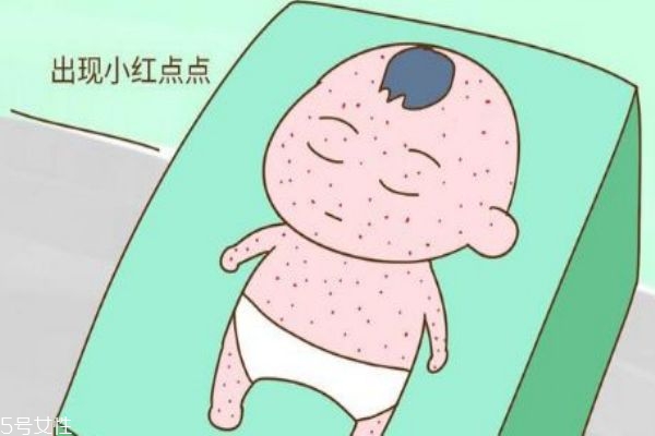 幼兒急疹和麻疹區(qū)別 3步看出寶寶是否是麻疹 幼兒急疹和麻疹區(qū)別 3步看出寶寶是否是麻疹