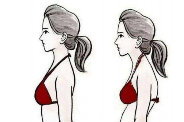 如何改變駝背的習(xí)慣 養(yǎng)成好習(xí)慣才可預(yù)防駝背 如何改變駝背的習(xí)慣 養(yǎng)成好習(xí)慣才可預(yù)防駝背