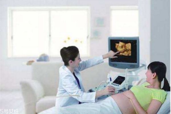 孕婦什么時候做四維彩超最好 孕婦什么時候做四維彩超最好