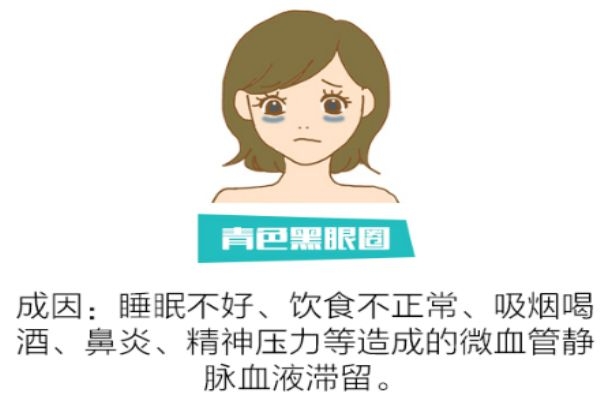 如何分辨黑眼圈類型 找對類型對癥下藥 如何分辨黑眼圈類型 找對類型對癥下藥