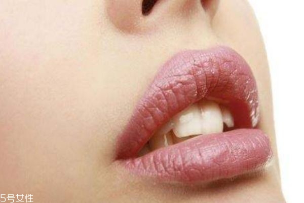 嘴巴長皰疹怎么辦 有可能引發(fā)這些疾病 嘴巴長皰疹怎么辦 有可能引發(fā)這些疾病