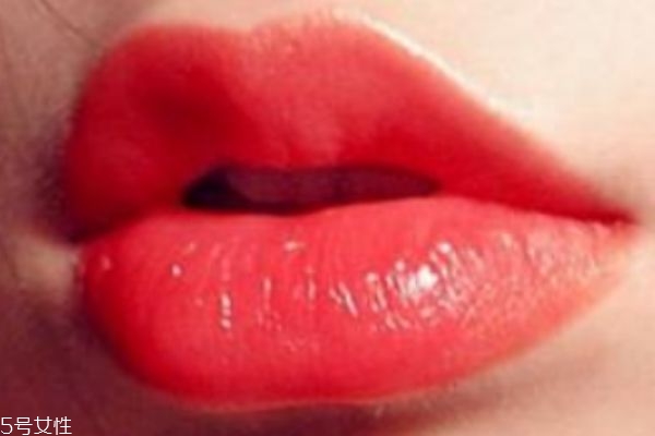 嘴巴長(zhǎng)皰疹怎么辦 有可能引發(fā)這些疾病 嘴巴長(zhǎng)皰疹怎么辦 有可能引發(fā)這些疾病