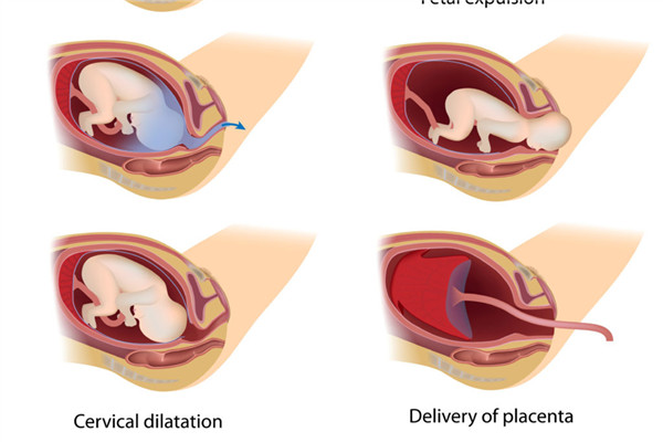 分娩過(guò)程的順序 全程疼痛劇烈 分娩過(guò)程的順序 全程疼痛劇烈