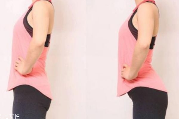 骨盆前傾會導致腿粗嗎 骨盆前傾會導致下身肥胖 骨盆前傾會導致腿粗嗎 骨盆前傾會導致下身肥胖