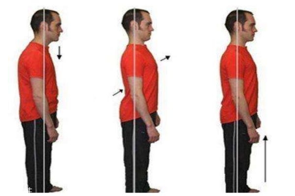 骨盆前傾的癥狀 骨盆前傾的自測辦法 骨盆前傾的癥狀 骨盆前傾的自測辦法