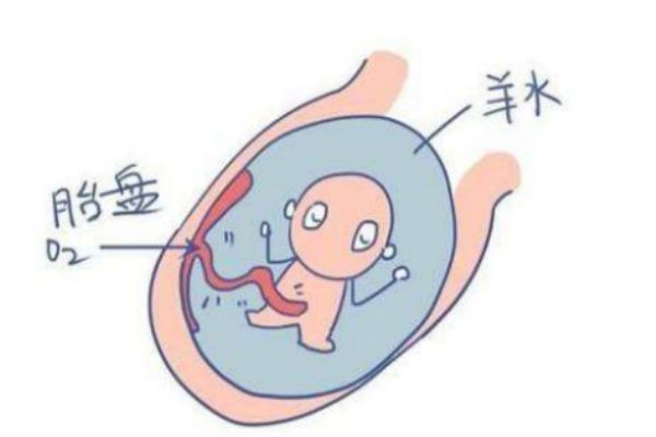 孕婦羊水過(guò)多什么癥狀 媽媽們要注意 孕婦羊水過(guò)多什么癥狀 媽媽們要注意