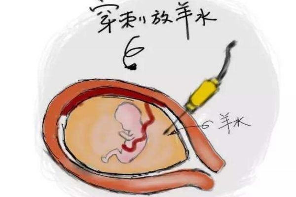 孕婦羊水過多對胎兒有害嗎 會(huì)危及胎兒性命 孕婦羊水過多對胎兒有害嗎 會(huì)危及胎兒性命