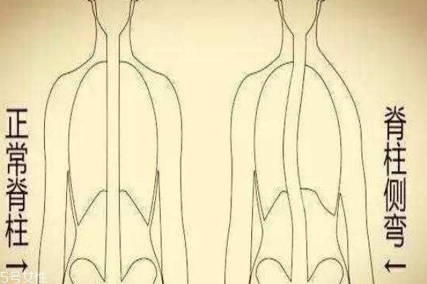 長短腿是什么引起的 下肢不對稱的表現(xiàn) 長短腿是什么引起的 下肢不對稱的表現(xiàn)