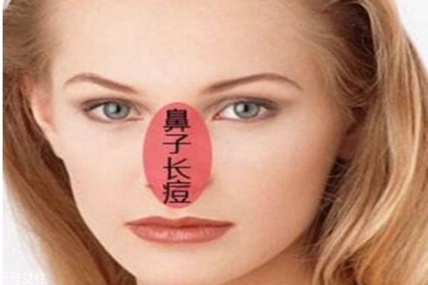 鼻子上長膿包型痘痘怎么處理 鼻子上長膿包多久會消 鼻子上長膿包型痘痘怎么處理 鼻子上長膿包多久會消