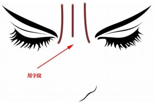 川字紋怎么形成的 怎么按摩消除川字紋 川字紋怎么形成的 怎么按摩消除川字紋