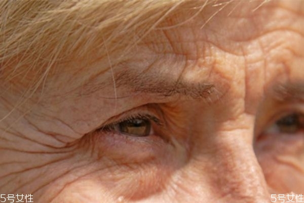 消除眼部皺紋的方法 簡(jiǎn)單有效的眼部去皺偏方 消除眼部皺紋的方法 簡(jiǎn)單有效的眼部去皺偏方