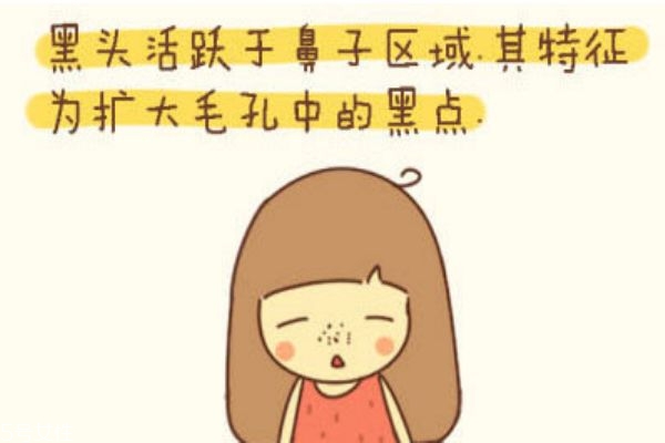 黑頭導(dǎo)出液的危害 黑頭導(dǎo)出液不能徹底清除黑頭 黑頭導(dǎo)出液的危害 黑頭導(dǎo)出液不能徹底清除黑頭