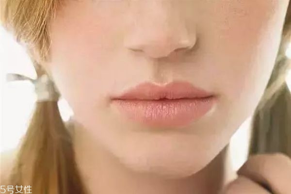去唇紋的方法有哪些 消除唇紋小妙招 去唇紋的方法有哪些 消除唇紋小妙招