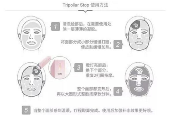 tripollar stop脖子能用嗎 tripollar stop使用時需注意 tripollar stop脖子能用嗎 tripollar stop使用時需注意