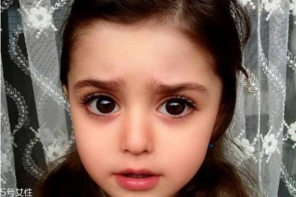 下眼睫毛往里長怎么辦 睫毛往眼睛里長 下眼睫毛往里長怎么辦 睫毛往眼睛里長