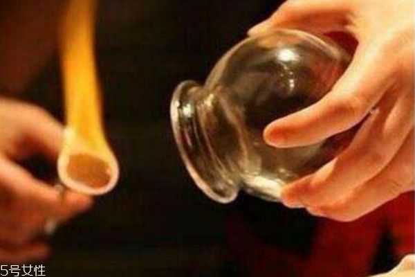 肚子減肥拔罐子拔哪個穴位 肚子減肥拔罐子拔哪個穴位