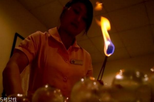 肚子減肥拔罐子拔哪個穴位 肚子減肥拔罐子拔哪個穴位