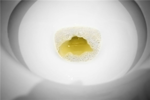 尿液有泡沫正常嗎 三種尿液情況要重視 尿液有泡沫正常嗎 三種尿液情況要重視