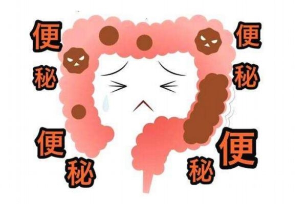 便秘的治療方法有哪些 坐班族輕敲膽經(jīng)防便秘 便秘的治療方法有哪些 坐班族輕敲膽經(jīng)防便秘