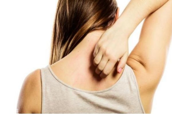 秋季皮膚干燥過敏癢怎么辦 秋季皮膚干燥癢 秋季皮膚干燥過敏癢怎么辦 秋季皮膚干燥癢