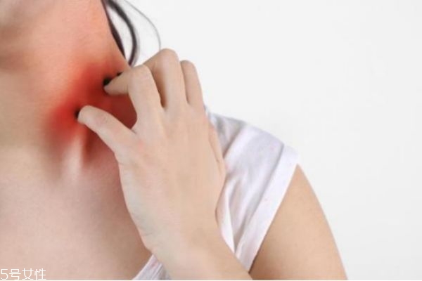 秋季皮膚干燥過敏癢怎么辦 秋季皮膚干燥癢 秋季皮膚干燥過敏癢怎么辦 秋季皮膚干燥癢