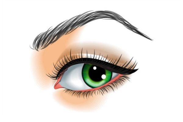 眼睛模糊看不清是怎么回事 眼睛模糊怎么辦 眼睛模糊看不清是怎么回事 眼睛模糊怎么辦